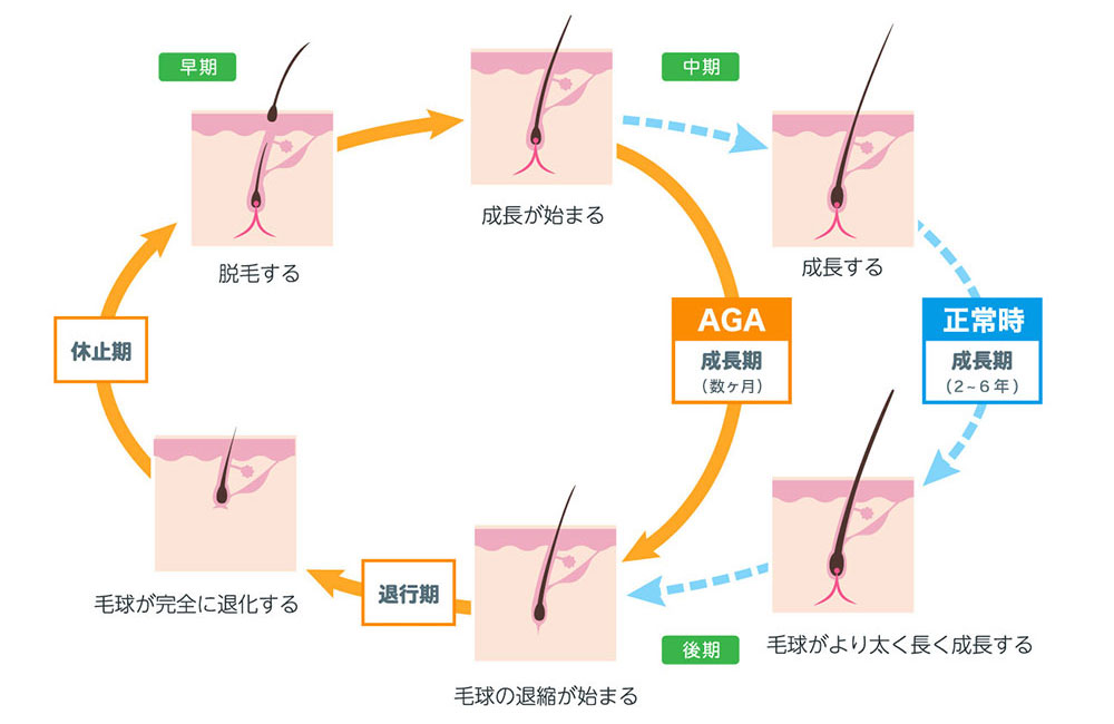 一般病院との比較毛髪サイクル